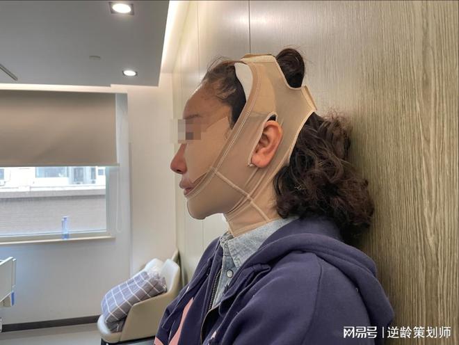 如何挑选适合自己的拉皮专家？面部提升修复案例黄金期饮食(图2)