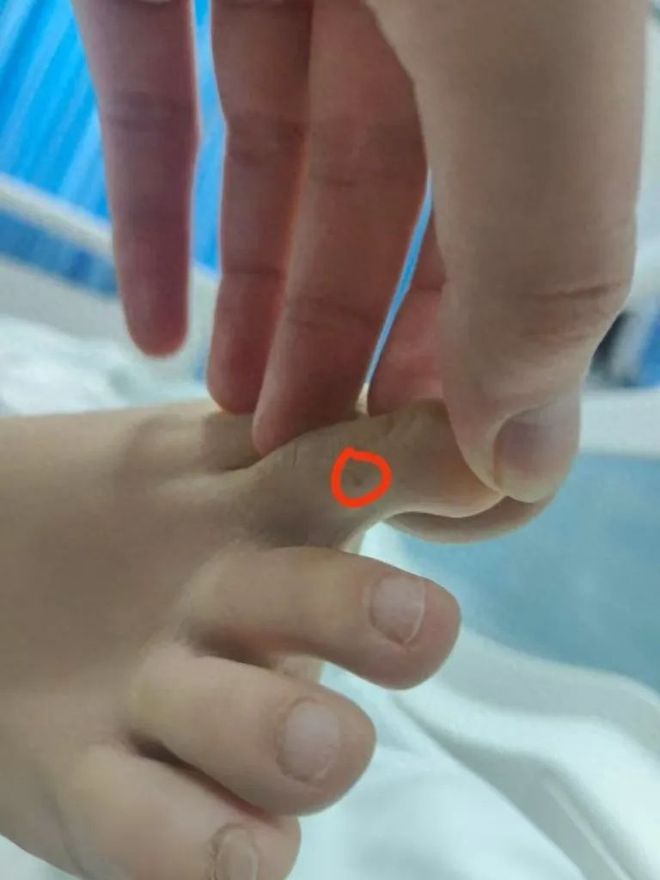 女子被不明物咬伤身亡海南公示29家各级医院抗蛇毒血清储备情况(图1)